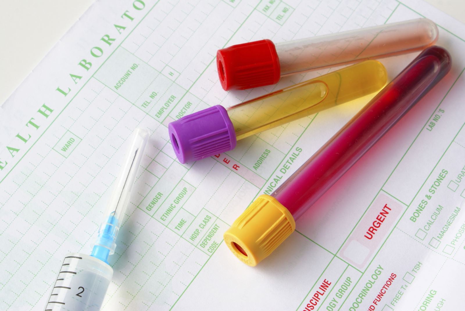 Guidelines issued on drug testing in the workplace